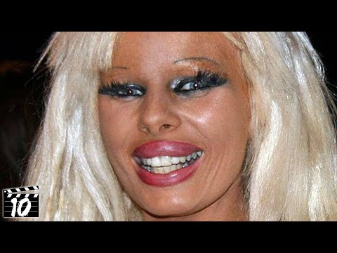 worst plastic surgery