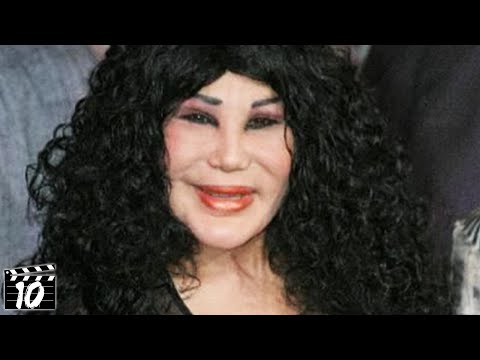 worst plastic surgery