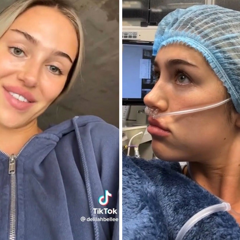 Delilah Hamlin Shares Hilarious TikTok of Herself Waking Up From Anesthesia After Wisdom Teeth Surgery