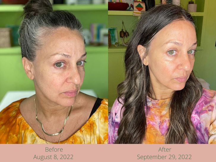 Kristen Philipkoski poses for before and after photos, Goop Vitamin C Serum review