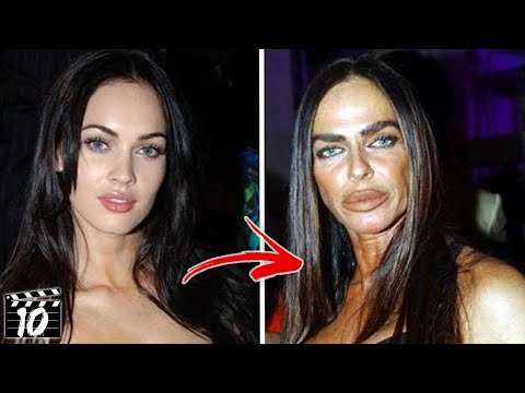 botched plastic surgeries