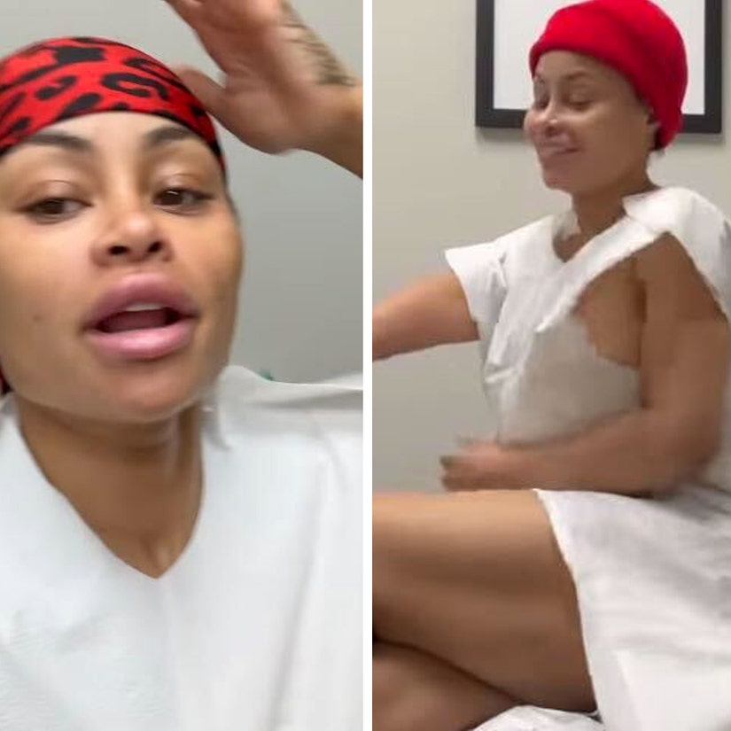 Blac Chyna Reveals She Got Breast and Butt Reduction
