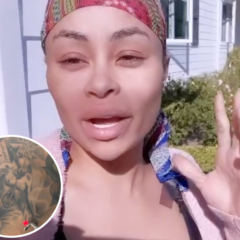 Blac Chyna Gets 'Demonic' Tattoo Removed As She Continues 'Life Changing Journey'