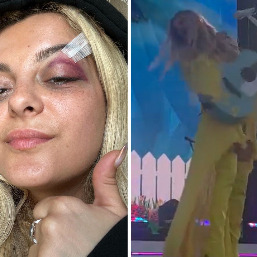 11 Musicians Who Suffered Scary On Stage Injuries