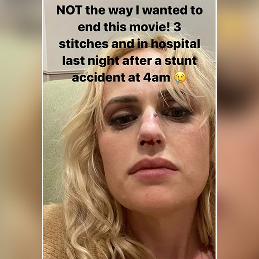 Rebel Wilson Needs Stitches After 'Stunt Accident' Wrapping Filming on Bride Hard