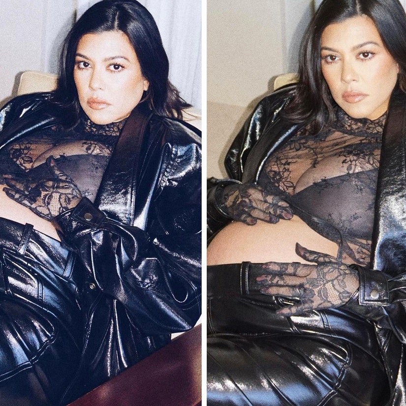 Kourtney Kardashian Shares 'Empowering' Pregnancy Photos After Emergency Surgery