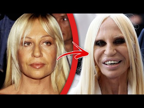 plastic surgery fails